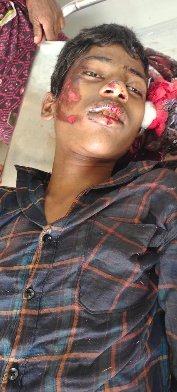 ఆటో ప్రమాదం లో హాస్టల్ విద్యార్థి మృతి