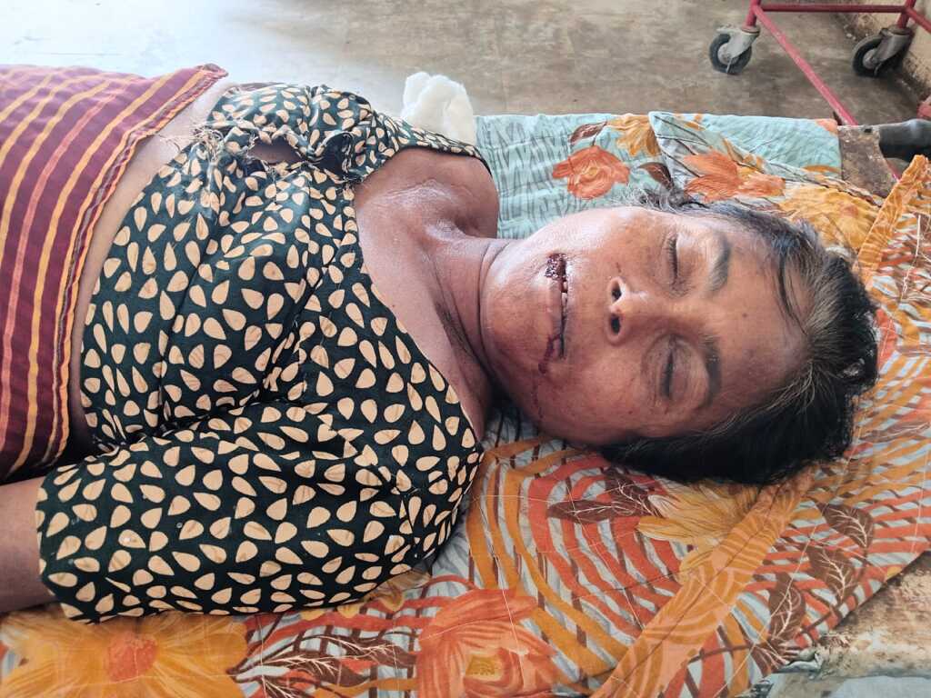కడుపునొప్పి భరించలేక పురుగుల మందు తాగి మహిళ మృతి