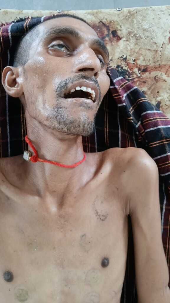 ఆటో నుండి కిందపడి యువకుడు మృతి