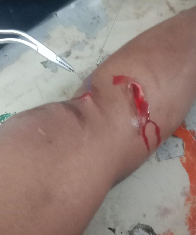 మద్యం మత్తులో అత్త పై ట్రాక్టర్ ఎక్కించిన అల్లుడు