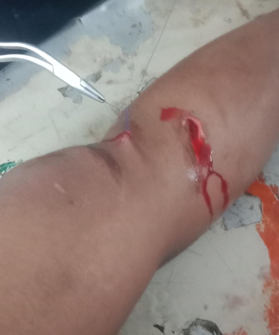 మద్యం మత్తులో అత్త పై ట్రాక్టర్ ఎక్కించిన అల్లుడు