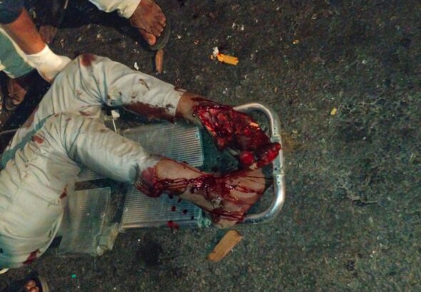 రేగొండలో ఘోర రోడ్డు ప్రమాదం–లారీ డ్రైవర్ మృతి